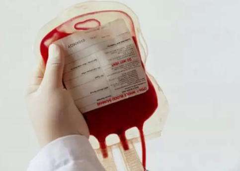 直系亲属之间竟不宜相互献血吗？