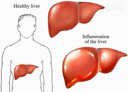 肝脏受损会有什么样的表现？